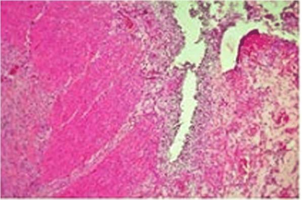 https://cdn.ncbi.nlm.nih.gov/pmc/blobs/38e7/6407268/11183ffe124a/13256_2019_1971_Fig4_HTML.jpg