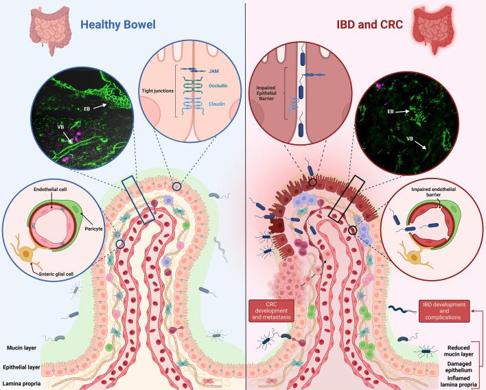 https://cdn.ncbi.nlm.nih.gov/pmc/blobs/38e8/11422792/940ef8f6b3d9/gutjnl-2023-331579f01.jpg