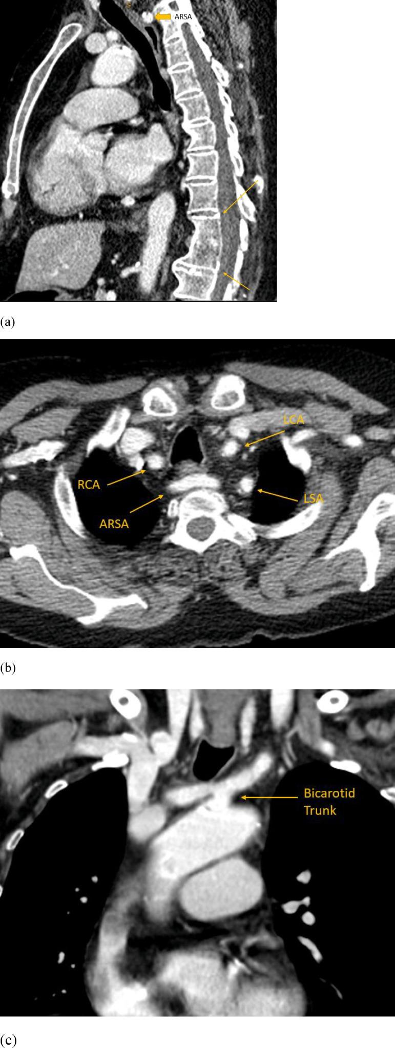 https://cdn.ncbi.nlm.nih.gov/pmc/blobs/38eb/8914094/1b70696b25e6/gr4.jpg