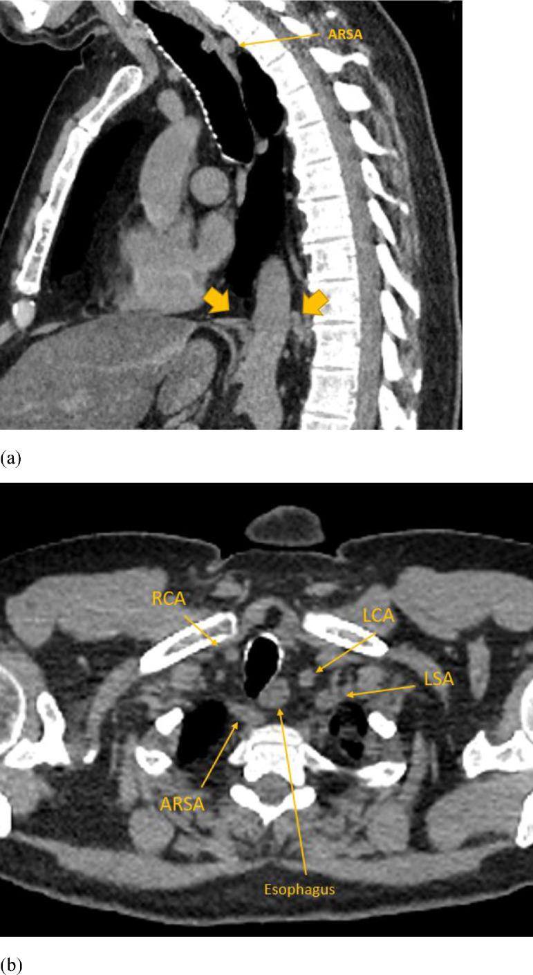 https://cdn.ncbi.nlm.nih.gov/pmc/blobs/38eb/8914094/4f91b7e9fd1d/gr2.jpg