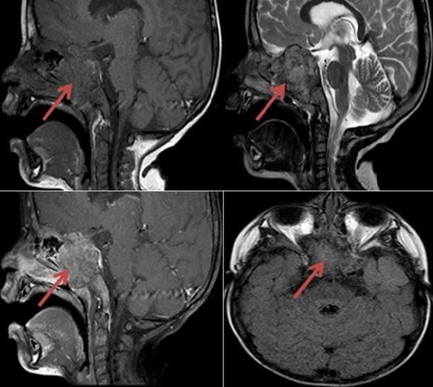 https://cdn.ncbi.nlm.nih.gov/pmc/blobs/38ed/6462382/4c456dcb6165/PAMJ-31-144-g001.jpg