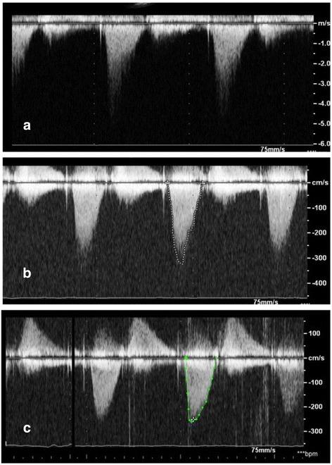 https://cdn.ncbi.nlm.nih.gov/pmc/blobs/38f2/4599754/5725c1c6f33e/12872_2015_108_Fig1_HTML.jpg