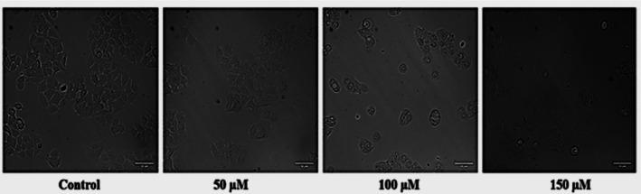 https://cdn.ncbi.nlm.nih.gov/pmc/blobs/38f4/12318615/0a03c0cb5e39/JCMM-29-e70747-g010.jpg