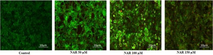 https://cdn.ncbi.nlm.nih.gov/pmc/blobs/38f4/12318615/0d851789ae20/JCMM-29-e70747-g007.jpg