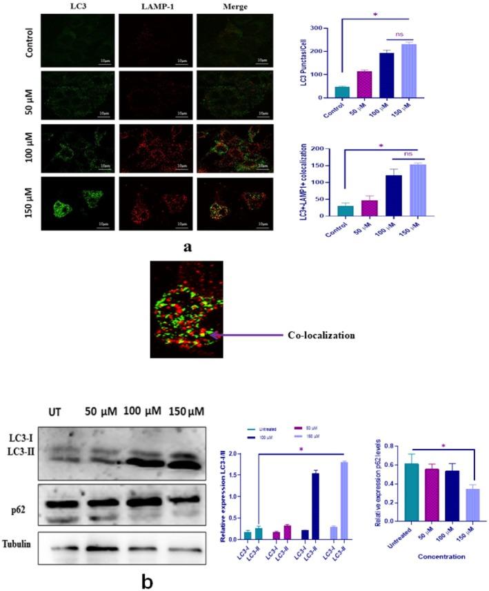 https://cdn.ncbi.nlm.nih.gov/pmc/blobs/38f4/12318615/133f79d86301/JCMM-29-e70747-g003.jpg