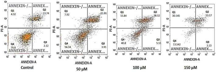 https://cdn.ncbi.nlm.nih.gov/pmc/blobs/38f4/12318615/dbd85cd11334/JCMM-29-e70747-g011.jpg