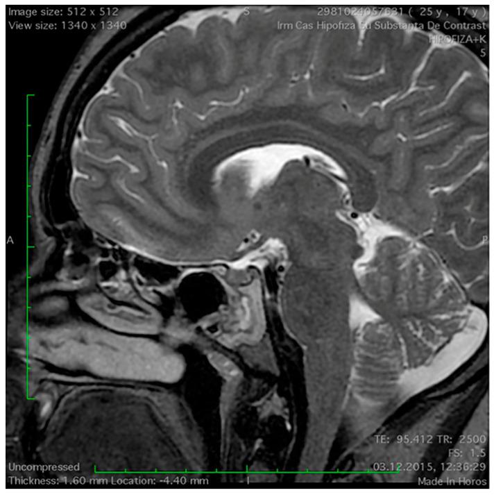 https://cdn.ncbi.nlm.nih.gov/pmc/blobs/38f6/11122816/ca65cbf69952/medicina-60-00708-g001.jpg