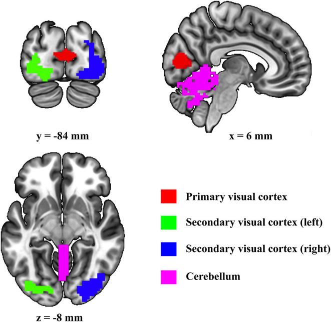 https://cdn.ncbi.nlm.nih.gov/pmc/blobs/38f8/8261284/dbc584dd5823/fnhum-15-632829-g0001.jpg