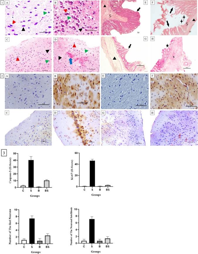 https://cdn.ncbi.nlm.nih.gov/pmc/blobs/38f9/12092513/305c1b34b0d3/424_2025_3084_Fig4_HTML.jpg