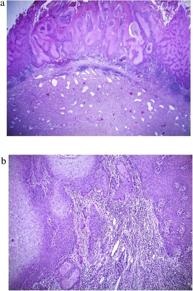 https://cdn.ncbi.nlm.nih.gov/pmc/blobs/3900/6351345/ab38fccd66d9/gr4.jpg