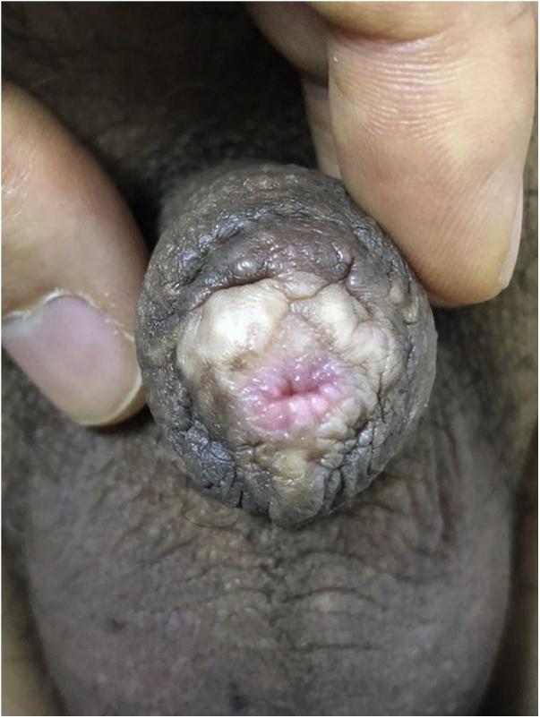 https://cdn.ncbi.nlm.nih.gov/pmc/blobs/3900/6351345/f5becc8c09c9/gr5.jpg