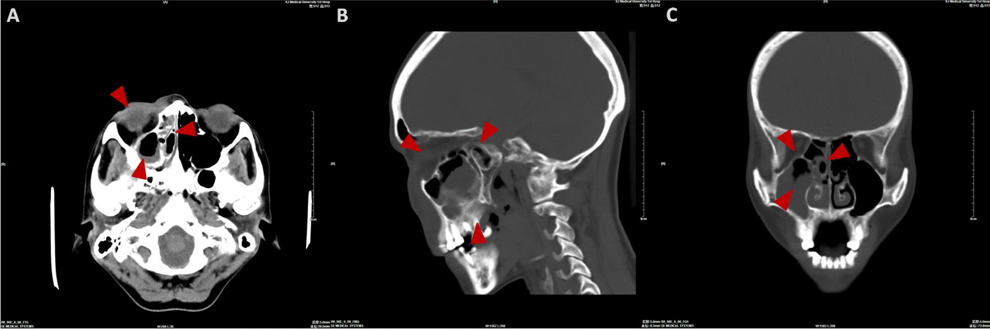 https://cdn.ncbi.nlm.nih.gov/pmc/blobs/3902/9942422/fccb50ecf488/12903_2023_2823_Fig2_HTML.jpg