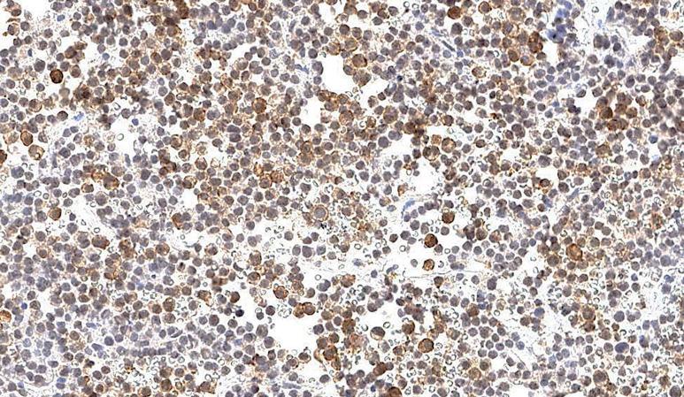 https://cdn.ncbi.nlm.nih.gov/pmc/blobs/3915/9753811/e3f24ec24900/problendo-67-12815-g001.jpg