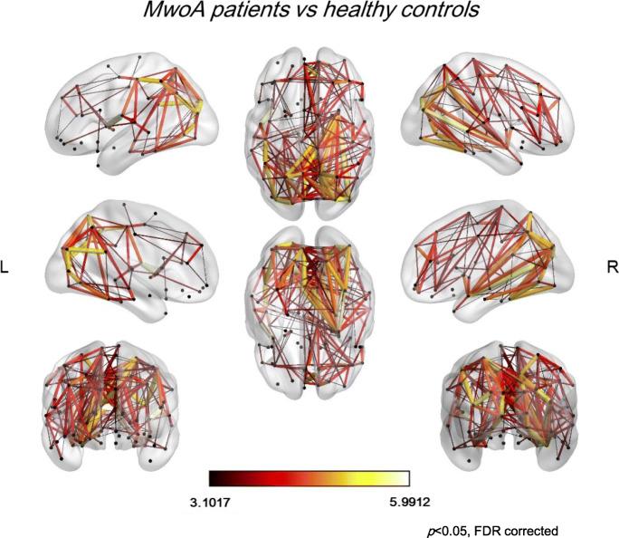 https://cdn.ncbi.nlm.nih.gov/pmc/blobs/391b/8400754/986435233031/10194_2021_1315_Fig3_HTML.jpg