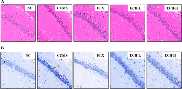 https://cdn.ncbi.nlm.nih.gov/pmc/blobs/391c/9846169/6cd07fcbc5bb/fphar-13-993483-g002.jpg