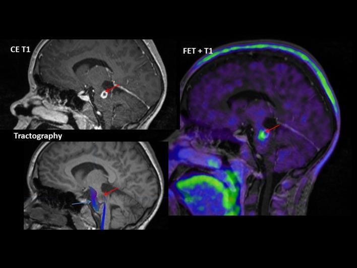https://cdn.ncbi.nlm.nih.gov/pmc/blobs/391d/5581366/a408e7053887/40336_2016_213_Fig3_HTML.jpg