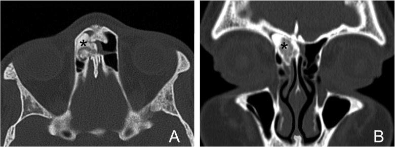 https://cdn.ncbi.nlm.nih.gov/pmc/blobs/3923/4035839/a95b601bc405/0392-100X-34-205-g004.jpg