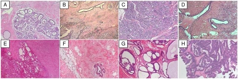 https://cdn.ncbi.nlm.nih.gov/pmc/blobs/392a/6440620/a620a3121f7f/pone.0214587.g005.jpg