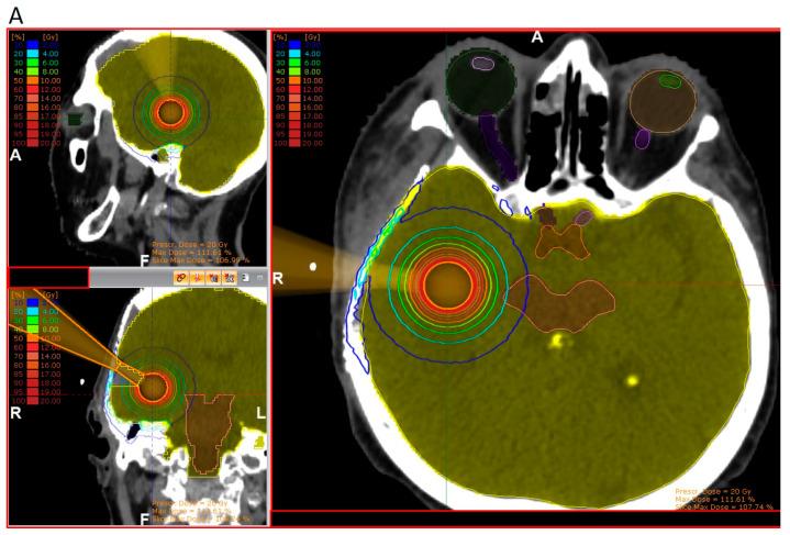 https://cdn.ncbi.nlm.nih.gov/pmc/blobs/392d/10377800/b9a3beed7031/cancers-15-03670-g002a.jpg