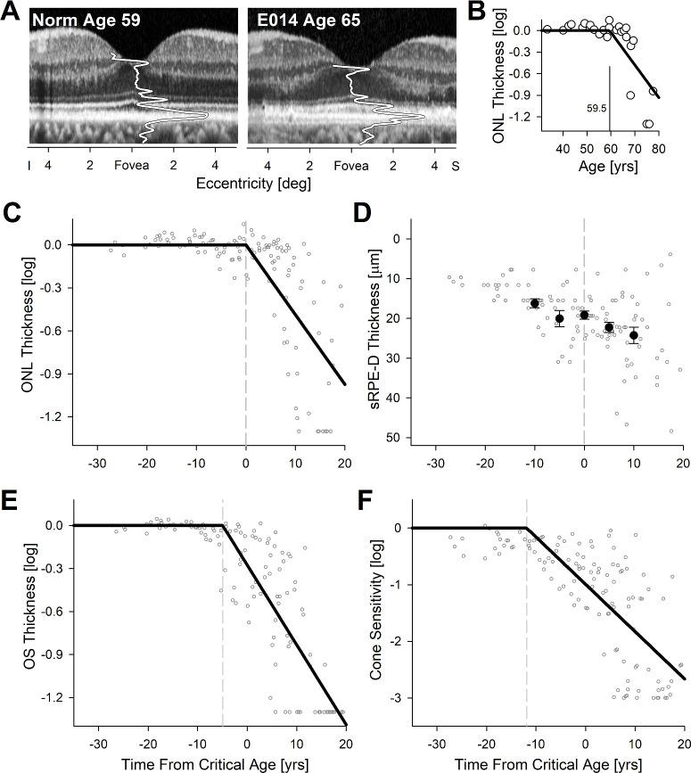 https://cdn.ncbi.nlm.nih.gov/pmc/blobs/3930/10746929/e32b929adf54/iovs-64-15-33-f004.jpg