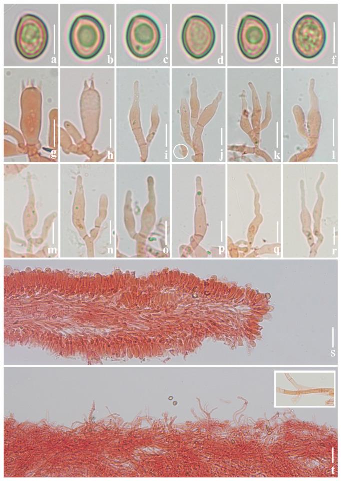 https://cdn.ncbi.nlm.nih.gov/pmc/blobs/3930/11508588/3180877b8a45/jof-10-00710-g003.jpg