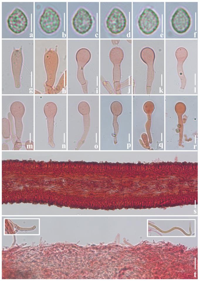 https://cdn.ncbi.nlm.nih.gov/pmc/blobs/3930/11508588/84a73ea0491a/jof-10-00710-g006.jpg