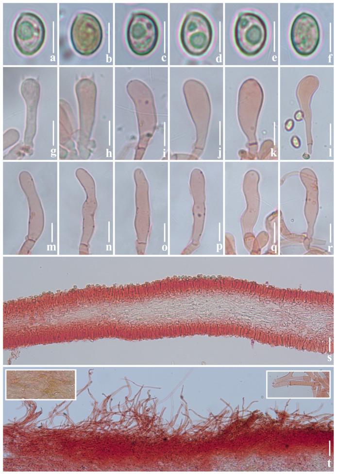 https://cdn.ncbi.nlm.nih.gov/pmc/blobs/3930/11508588/8558b00c9897/jof-10-00710-g012.jpg