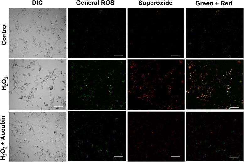 https://cdn.ncbi.nlm.nih.gov/pmc/blobs/3930/5288878/728283996456/12906_2017_1581_Fig3_HTML.jpg