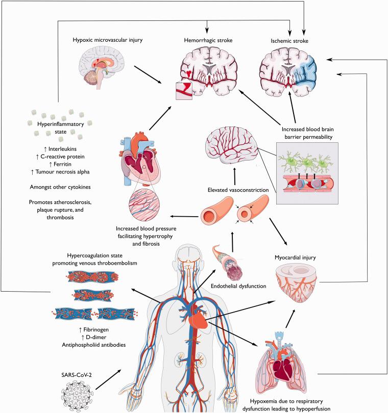 https://cdn.ncbi.nlm.nih.gov/pmc/blobs/393c/7859578/c66a95e8aa6b/10.1177_1747493020972922-fig3.jpg