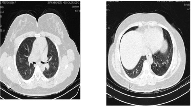 https://cdn.ncbi.nlm.nih.gov/pmc/blobs/393e/9163488/1c6d572d3284/gr1.jpg