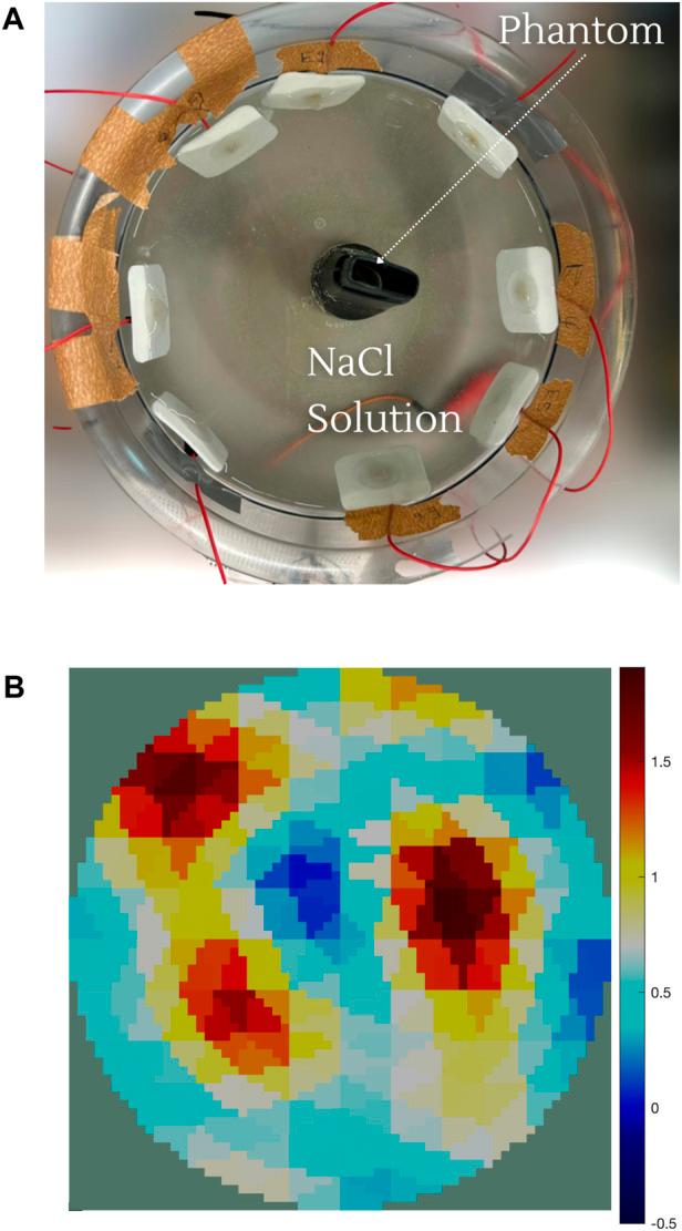 https://cdn.ncbi.nlm.nih.gov/pmc/blobs/3941/11670078/a1b4daecf08a/fbioe-12-1486789-g004.jpg