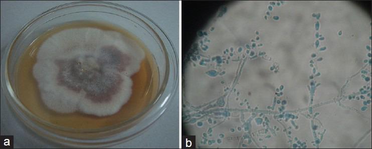 https://cdn.ncbi.nlm.nih.gov/pmc/blobs/3942/3968735/680d65d939b9/IJEM-18-63-g009.jpg