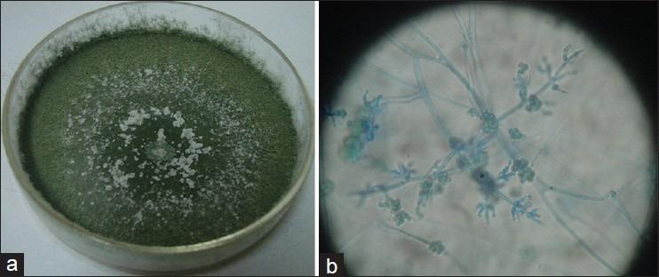 https://cdn.ncbi.nlm.nih.gov/pmc/blobs/3942/3968735/aca5d26f40a1/IJEM-18-63-g008.jpg