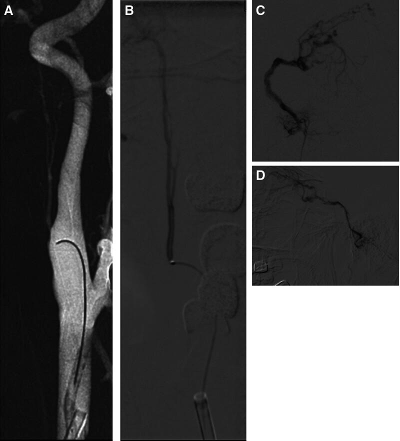 https://cdn.ncbi.nlm.nih.gov/pmc/blobs/3944/12187352/1bcabcb5ab68/medi-104-e42836-g002.jpg