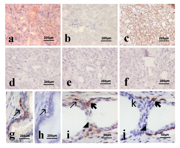 https://cdn.ncbi.nlm.nih.gov/pmc/blobs/3945/2913964/589fb6bf0aa9/1471-2407-10-385-3.jpg