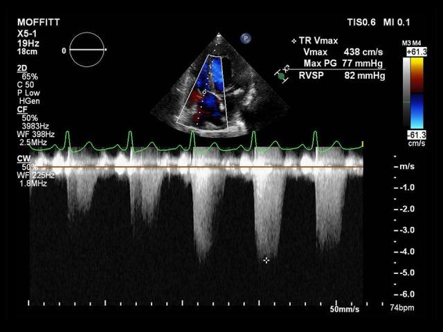 https://cdn.ncbi.nlm.nih.gov/pmc/blobs/3946/6640173/c957aa28f20f/amjcaserep-20-998-g001.jpg