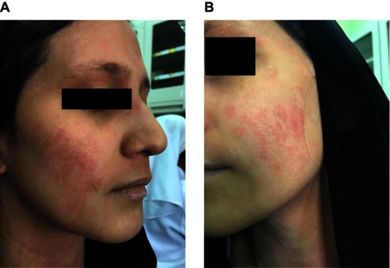 https://cdn.ncbi.nlm.nih.gov/pmc/blobs/3950/6526326/69730e13c36f/BTT-13-79-g0001.jpg