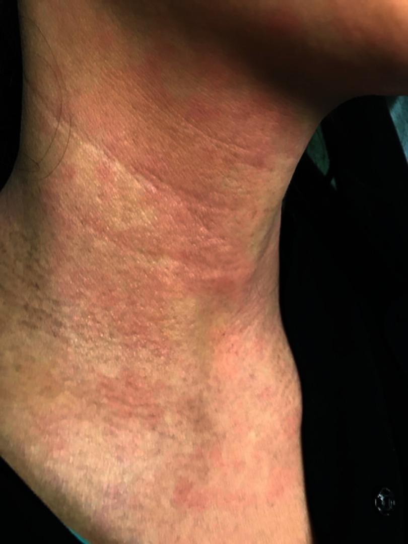 https://cdn.ncbi.nlm.nih.gov/pmc/blobs/3950/6526326/ec91f93d13fd/BTT-13-79-g0002.jpg