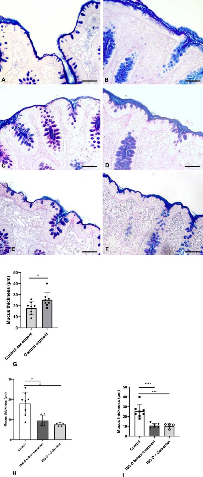 https://cdn.ncbi.nlm.nih.gov/pmc/blobs/3953/11485395/82d439a2d9fb/UEG2-12-1102-g002.jpg