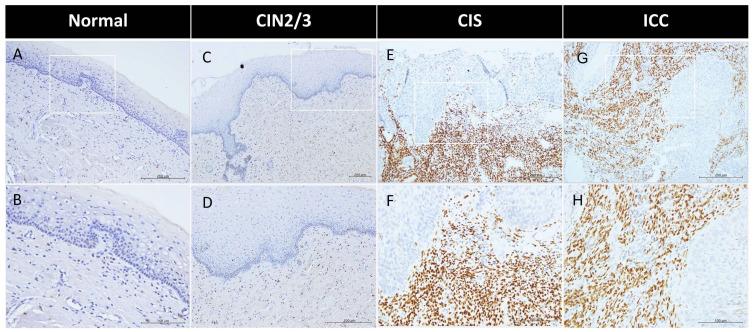 https://cdn.ncbi.nlm.nih.gov/pmc/blobs/395a/12073007/a3c77ac7b56f/ijms-26-04418-g001.jpg