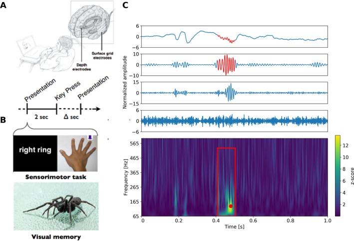 https://cdn.ncbi.nlm.nih.gov/pmc/blobs/395d/6144446/d436ca8f4470/ACN3-5-1062-g001.jpg