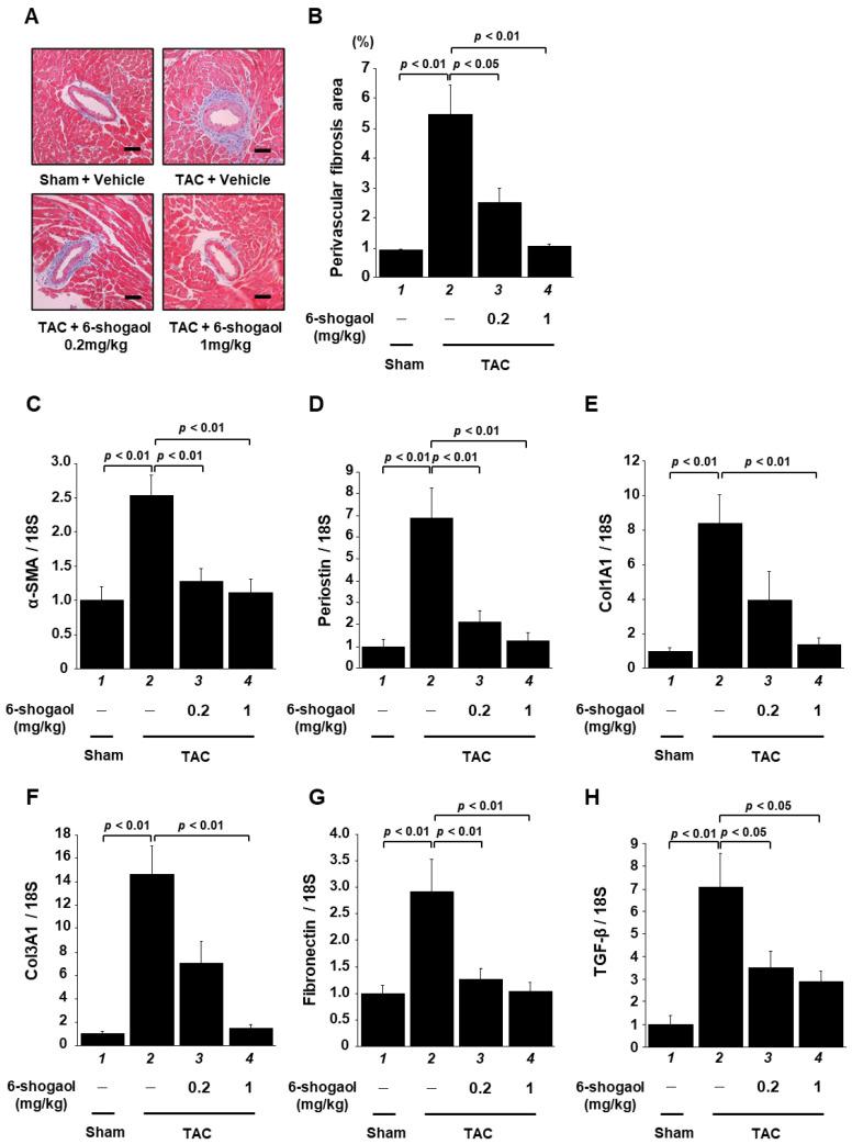https://cdn.ncbi.nlm.nih.gov/pmc/blobs/395f/10181444/df8104b609d5/nutrients-15-02232-g007.jpg