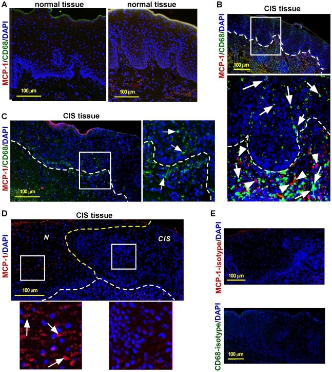 https://cdn.ncbi.nlm.nih.gov/pmc/blobs/3960/2882331/4767ccfa7ff6/pone.0010993.g003.jpg