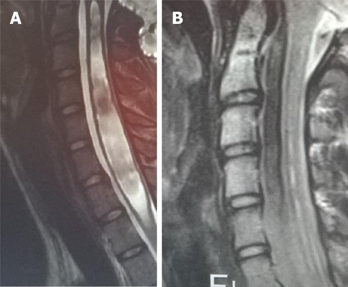 https://cdn.ncbi.nlm.nih.gov/pmc/blobs/3960/7852648/7fd19e4970f7/WJCC-9-764-g008.jpg