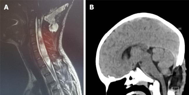 https://cdn.ncbi.nlm.nih.gov/pmc/blobs/3960/7852648/b194e3c60e41/WJCC-9-764-g010.jpg