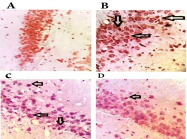 https://cdn.ncbi.nlm.nih.gov/pmc/blobs/3963/6396990/a9f83dde6855/IJBMS-22-154-g004.jpg
