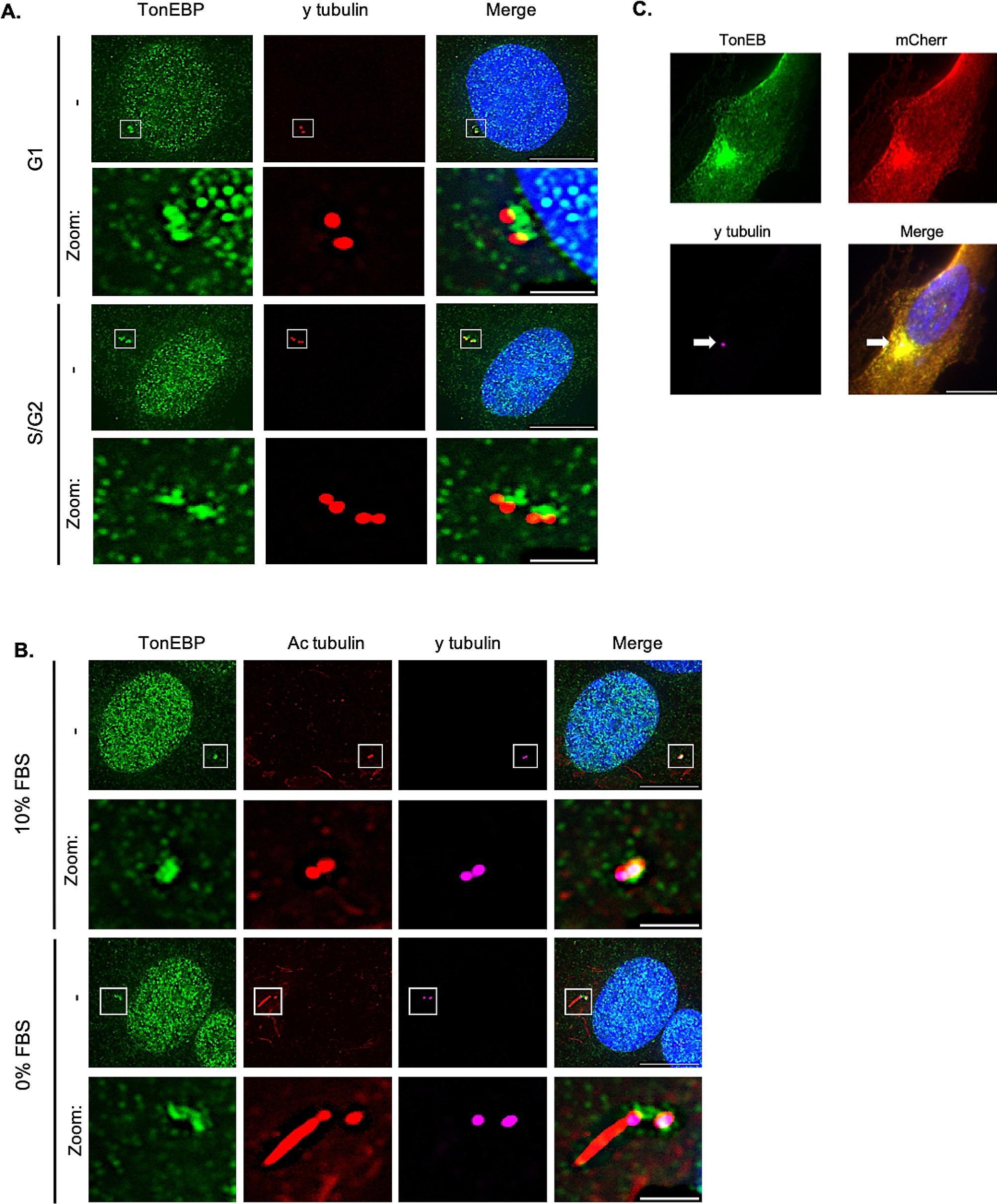https://cdn.ncbi.nlm.nih.gov/pmc/blobs/3966/11221002/595e76e92f98/12964_2024_1721_Fig1_HTML.jpg