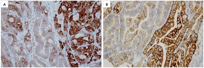 https://cdn.ncbi.nlm.nih.gov/pmc/blobs/3966/5354657/769844d80931/oncotarget-08-10264-g002.jpg