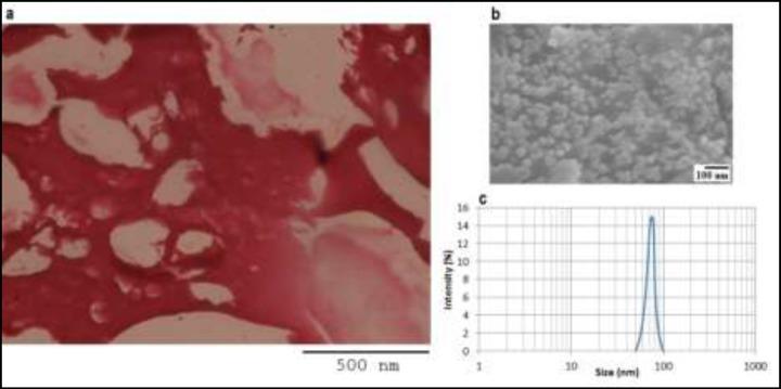 https://cdn.ncbi.nlm.nih.gov/pmc/blobs/396d/4426153/a43fc60ab703/ijrm-3-141-g001.jpg