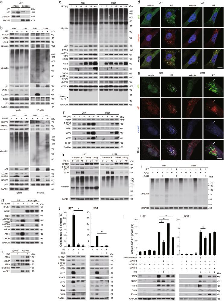 https://cdn.ncbi.nlm.nih.gov/pmc/blobs/396f/5978811/67694eeeef71/41388_2018_180_Fig5_HTML.jpg